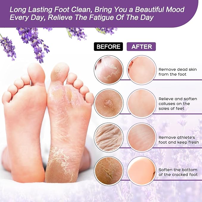 foot salt set Foot Soak with Epsom Salt - For Toenail Repair, Athletes Foot, Softens Calluses, Soothes Sore & Tired Feet…