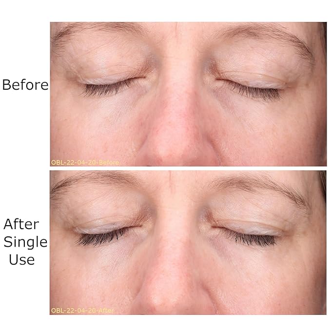 Hydrate & Soothe Beauty Collection, Activator with Awaken Facial & Vitamin B Concentrate, Face smoothing moisturizer, Skin Care Routine, For All Skin Type, Gift Bundle/Starter Kit