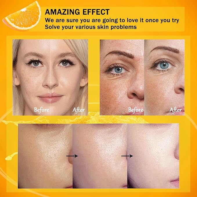 Vitamin C Skincare Set, 5Pcs Skin Care Sets for Women, Facial Kit, Vitamin C Face Skin Care Kit With Cleanser, Toner, Face Serum, Eye Cream, Cream, Long-Lasting Moisturizing Skincare Set