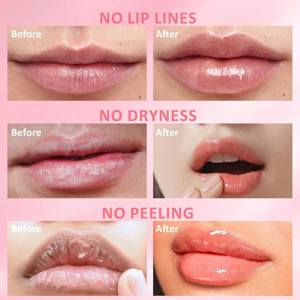 DMSKY Bee Lip Balm Honey Pot 6 PCS, Nourish & Hydrate Lip Sleeping Mask with Vitamin E, Lip Mask Overnight for Dry Lips, Reduces Lip Lines