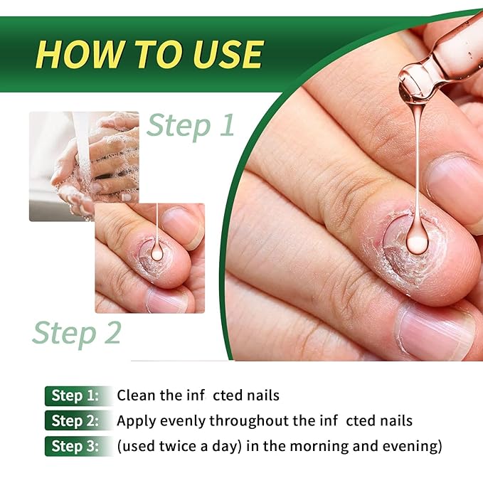 2PCS Ginger Nail Treatment, Ginger Cuticle Care Oil for Nails, Multi-Purpose Nail Repair Nutrient Oil (01)