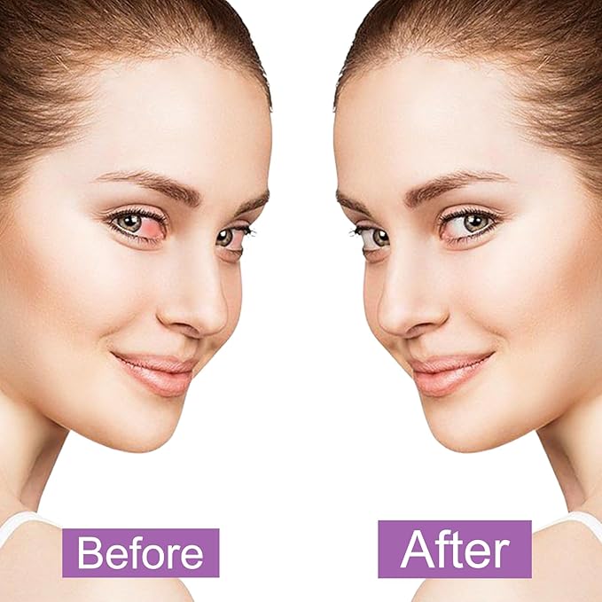 20 Pack Steam Eye Masks for Dry Eyes, Disposable Heated Eye Mask Self Heating Warm Compress for Eyes, Relief Eye Fatigue Hot Sleep Mask for Men Women, Lavender