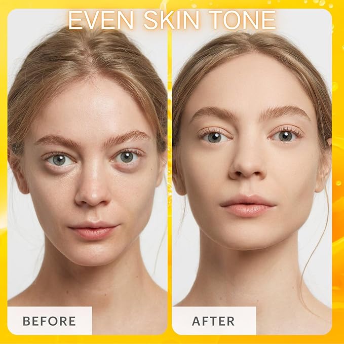 Vitamin C Skincare Set, 5Pcs Skincare Gift Set With Cleanser, Toner, Face Serum, Face Cream, And Eye Cream, Facial Kit for Women, 5-In-1 Skin care Gift Set, Moisturizing Skincare Set For Women Men