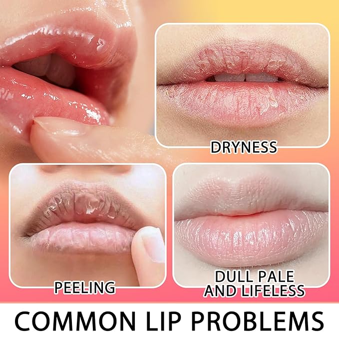 Strawberry and Orange Flavour Lip Scrubs Set,2 Pack Hydrating Lip Scrubber Exfoliator,Lip Moisturizer Care Product for Chapped Dry Dark Lips