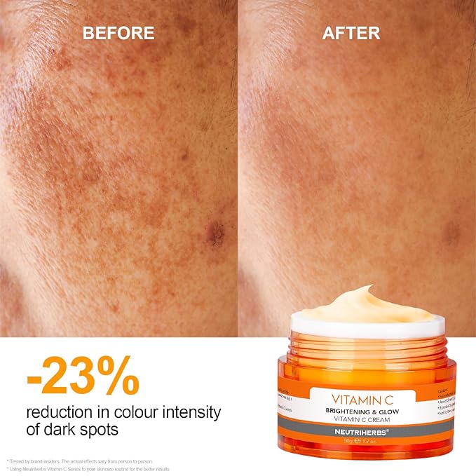 Neutriherbs Vitamin C Face Cream, Day & Night Facial Moisturizer, Daily Skin Care, Brighten, Lighten Skin, Moisturizing Softening Smoothing Skin 1.7oz