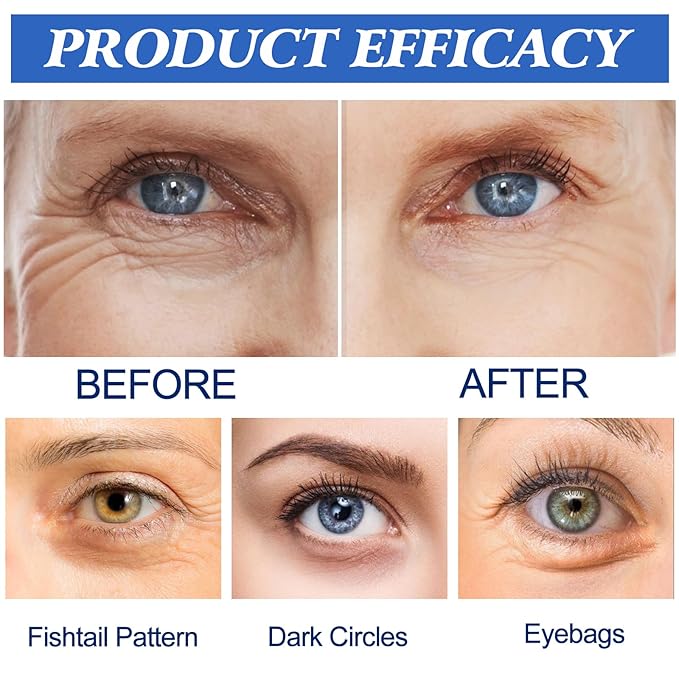 Malora Microglow Eye Patches, Malora Eye Patch, Deep Moisturize Microglow Patches, for Wrinkles, Dark Circles and Puffiness Wrinkle Eye Bags