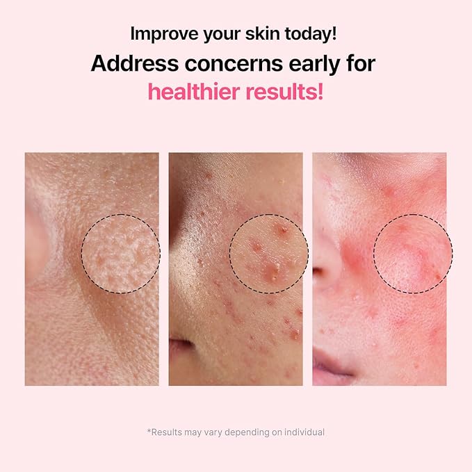 Pore Refining Ampoule, Pore Tightening, Reduce Sebum, Korean Skin Care, Vegan, 1.69 Fl Oz