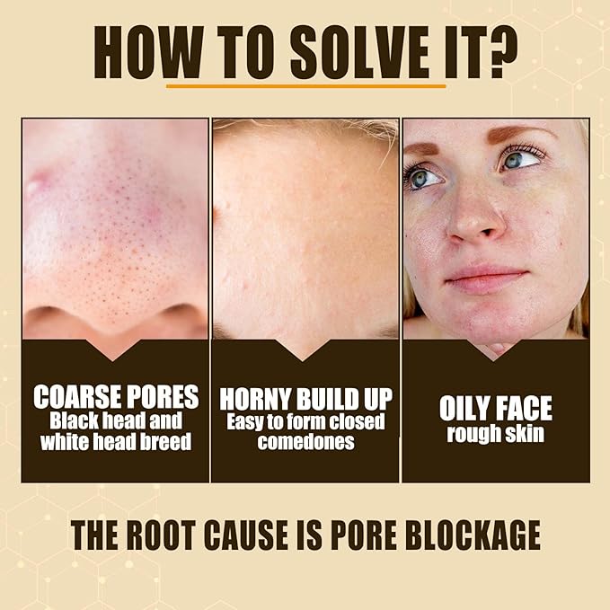 Lactobionic Acid Pore Refining Serum,Minimize Pores Serum Gentle Formula Clean Pore Shrink Pore Firming Skin Reduce Fine Lines Facial Liquid for All Skin