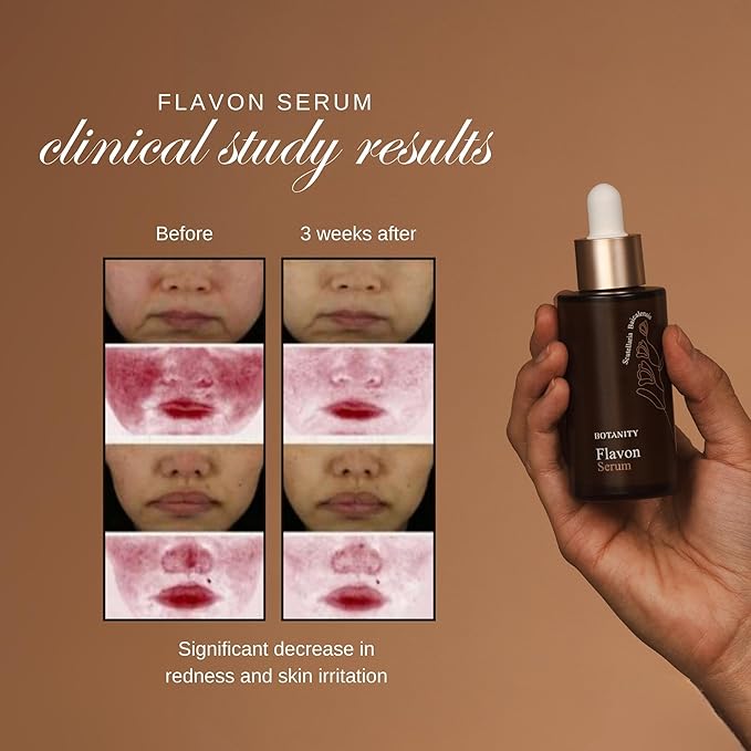 Flavon Serum - Strenthen skin moisture barrier, calming and soothing dry & sensitive skin, K-beauty, Made in Korea, 1.7 fl oz