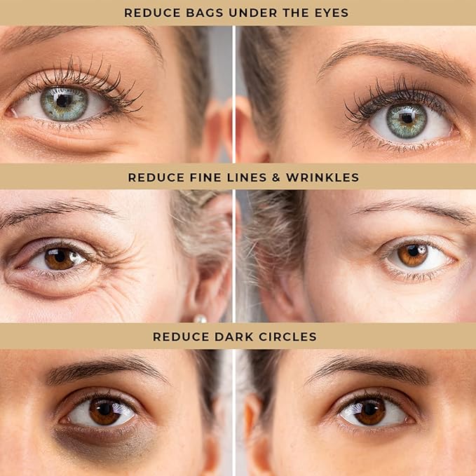 Temporary Eye Tightener Eye Cream for Under-Eye Bags, Dark Circles & Puffiness, Anti Aging Fine Lines, Firm That Delicate Skin Under Your Eyes, 30Ml