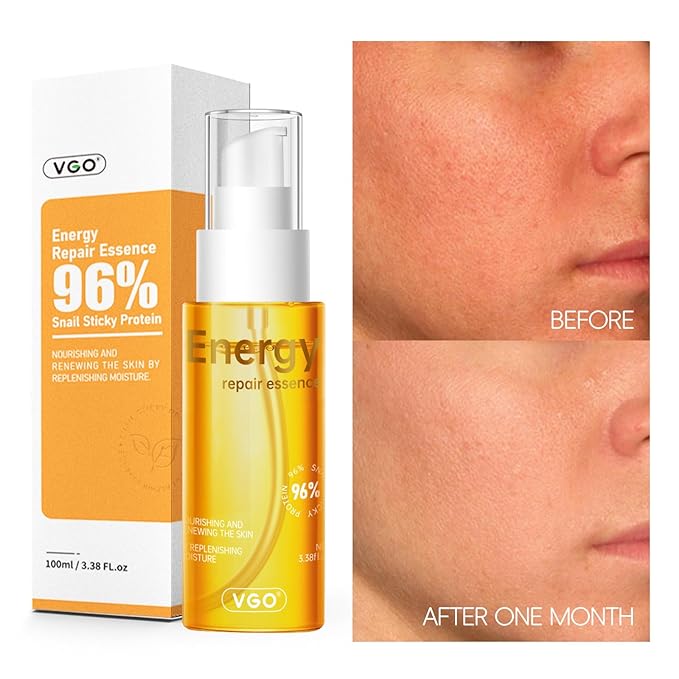 VGO 96% Snail Mucin Serum - Advanced Hydrating & Anti-Aging Snail Extract Serum for Smooth, Radiant Skin - Face Serum Repair & Moisturizing Formula - Suitable for All Skin Types, 100ml / 3.38 fl.oz