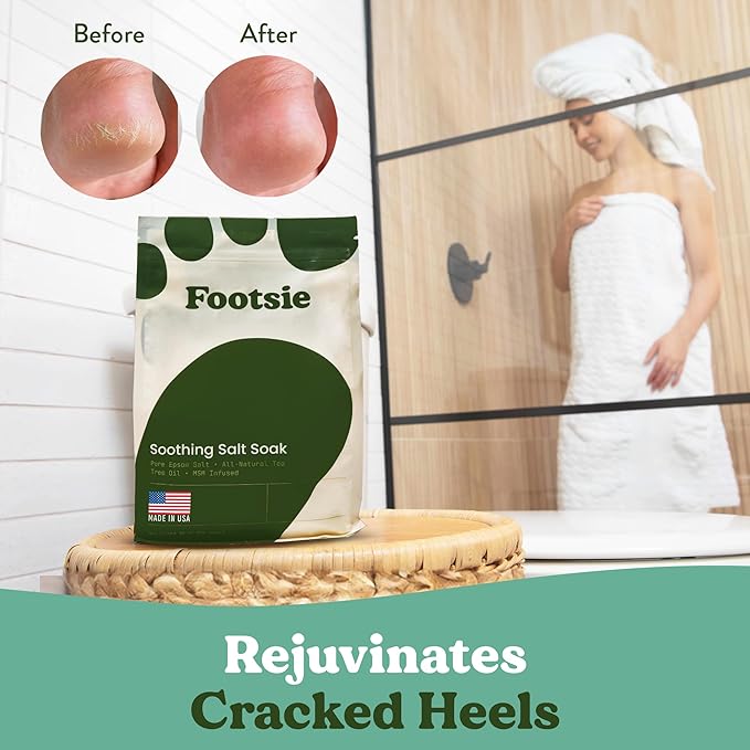Footsie Soothing Tea Tree Oil Epsom Salt Soak - for Calluses, Aches & Pain, Athlete's Foot - Made in USA - Soothes Cracked Heels, Flaky Skin - 100% Organic, Pedicure Spa Salt - (Calluses & Cracks)