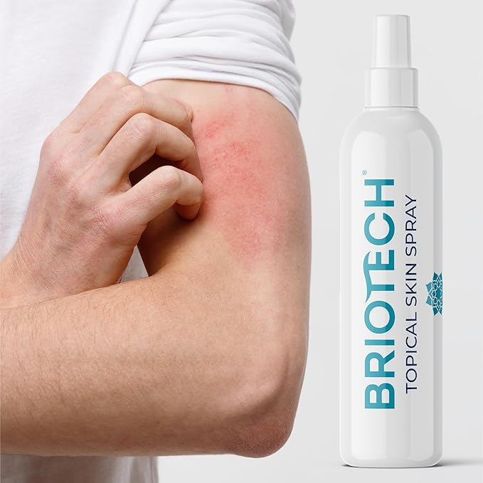 BRIOTECH Topical Skin Spray, Hypochlorous Acid Spray for Body & Face, Eyelid Cleanser, HOCl Facial Mist, Support Against Irritation and Redness, Packaging May Vary, 4 oz, 1 ct