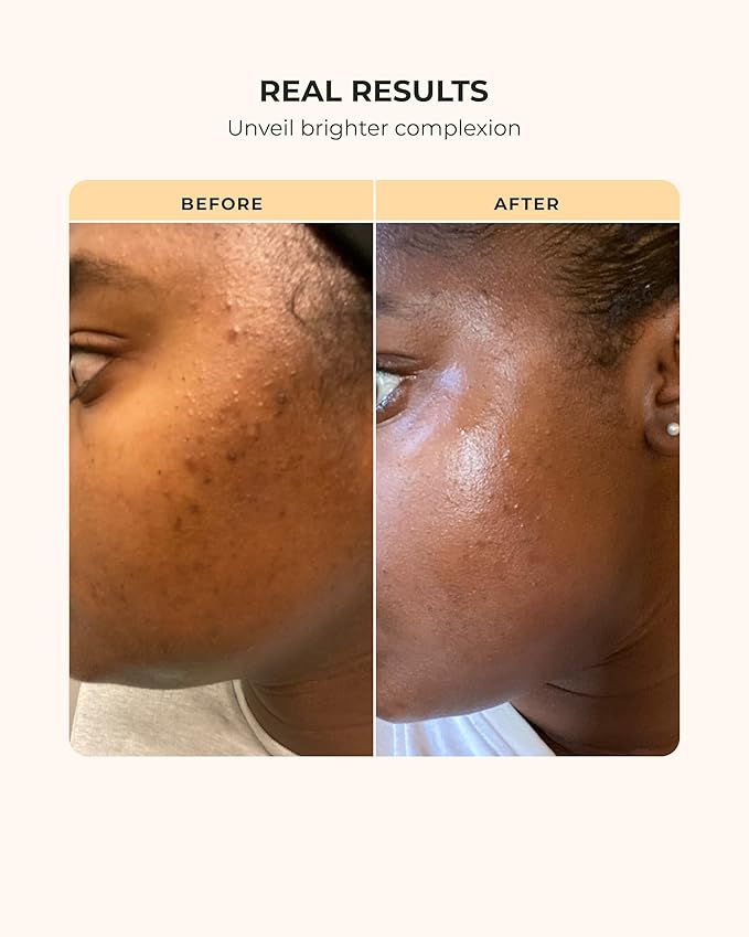 Buttah Skin Supreme Kit for Melanin Rich Skin | Facial Shea Butter 2 oz | Vitamin C Serum 1 oz | Cleanser 3.4 oz | Rosewater Toner 3.4 oz | Black Owned Skincare