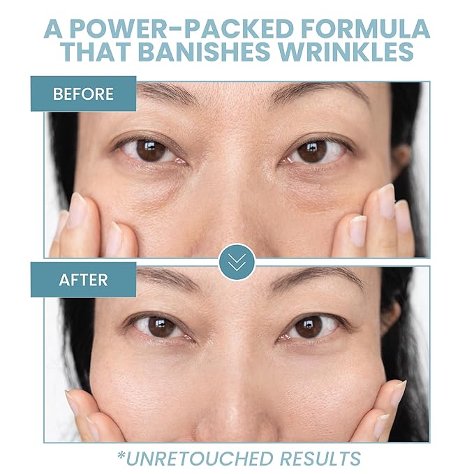 Anti-Aging Eye Gel - Luxurious Hydrating Under Eye Cream For Dark Circles and Puffiness, Bags, Crows Feet, Wrinkles - With Hyaluronic Acid & Skin-Firming Peptides Serum (2 oz.)