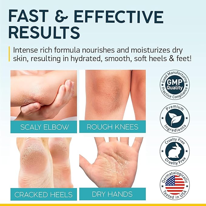 NUVADERMIS Urea Cream 40% for Feet – Maximum Strength Foot Repair Lotion with 2% Salicylic Acid, Shea Butter, Tea Tree Oil, and Vitamin E – For Dry, Cracked Heels – 5.29 oz Jar - 2 Pack