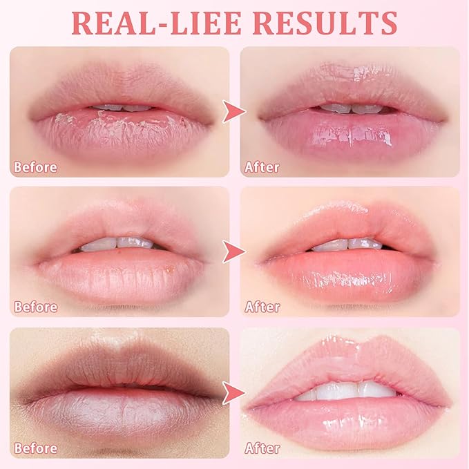 4 Pcs Honey Lip Balm, Bee Lip Balm Honey Pot,Moisturizing Lip Mask Overnight,Hydrate Repair Prevent Dry Cracked Lip Care(Honey+Strawberry+Watermelon+Apple)