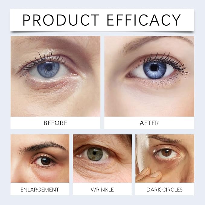 Retinol Under Eye Cream, Anti-aging Eye Cream for Eye Bags, Retinol Eye Cream for Dark Circles, Puffiness and Wrinkles, Suitable for all skin types (0.51 Fl Oz)