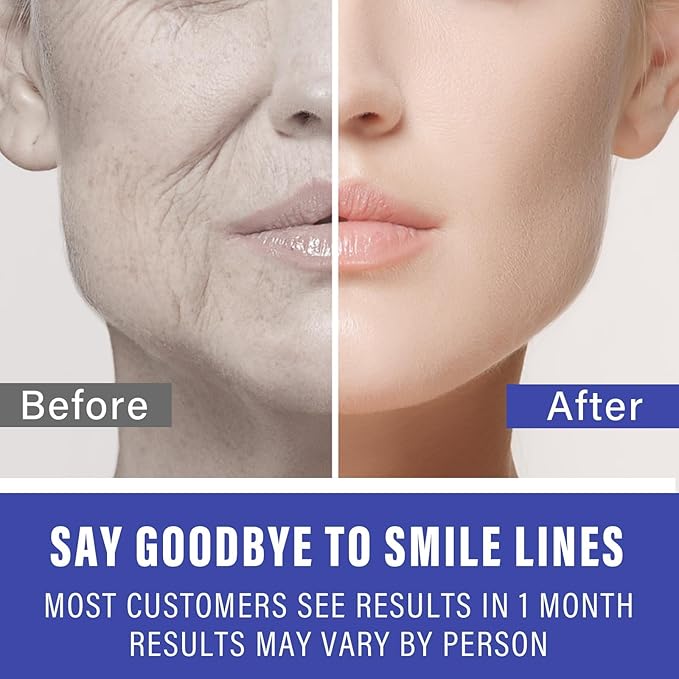 Smile Line Patches, 16PCS Anti Wrinkle Patches, the Smile Lines Treatment for Fine Wrinkles between Eyes and Face