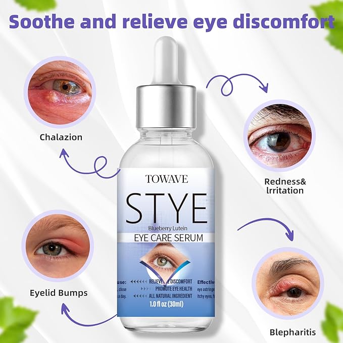 Stye Eye Treatment, Natural Relief Drops Serum for Styes Chalazion and Blepharitis, Fast Chalazion Remover for Restore Healthier Eye Skin (1 Fl Oz (Pack of 1), Original)