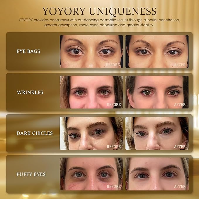 Gold Infused Eye Patches - 24K Gold Eye Masks for Dark Circles, Puffy Eyes, and Wrinkles, Anti-Aging Treatment with Collagen & Hyaluronic Acid, Deep Hydration & Firming (60 Pcs)