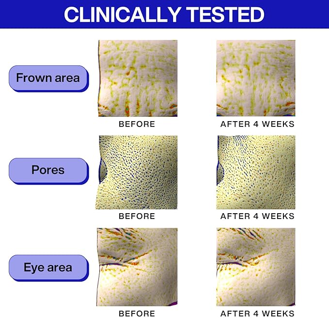 IOPE Retinol Super Bounce Serum - Korean Retinol Eye Cream, Intensive Reactivating Korean Retinoid, Anti-Aging, Reduction in Fine Wrinkles, Beginner Friendly, 1.01 Fl Oz.