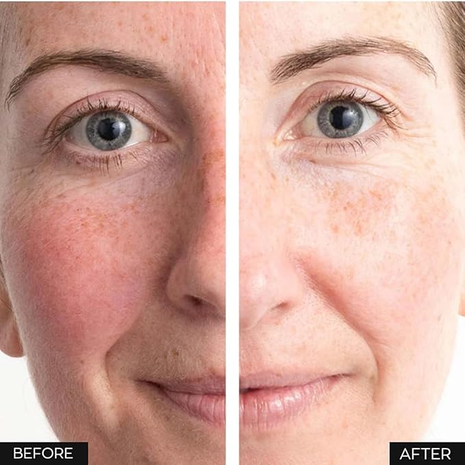 Anew Skin Renewal Power Serum - Dual-Collagen Boost, Protinol Technology, 30ml Powerful Results in 7 Days. Smoothes Skin, Reduces Pores and Minimises Lines for Firmer, Stronger,