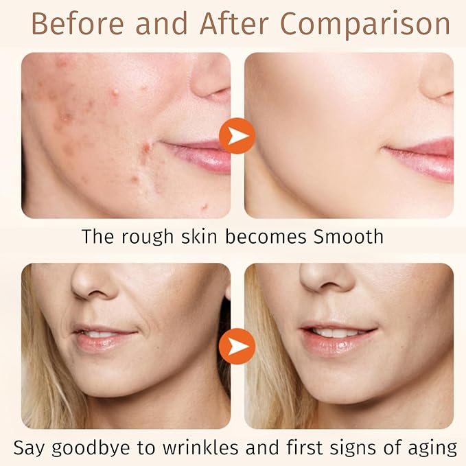 Oats Skincare Set Mom Women Gift - Pregnancy Must Haves - 7PCS Skin Care Set - Anti-Wrinkle New Mom Gifts - Skin Care Products - Skin Care Kit with Toner, Stretch Mark Oil, Serum, Face Mask