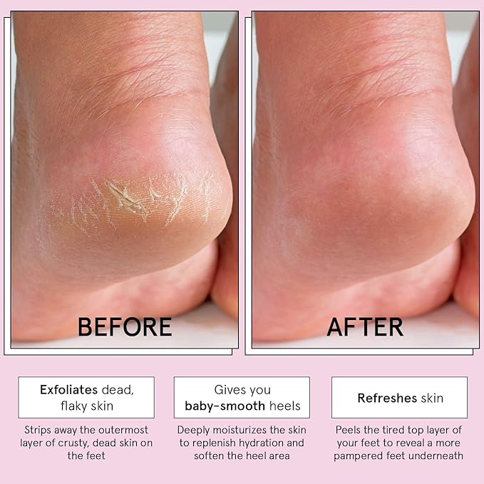 grace & stella Award-Winning Foot Peel Mask - Foot Peeling Mask with Aloe Vera - Moisturizing Foot Mask for Dry Cracked Feet - Foot Exfoliator for Baby Soft Feet (2 Pairs, Unscented)