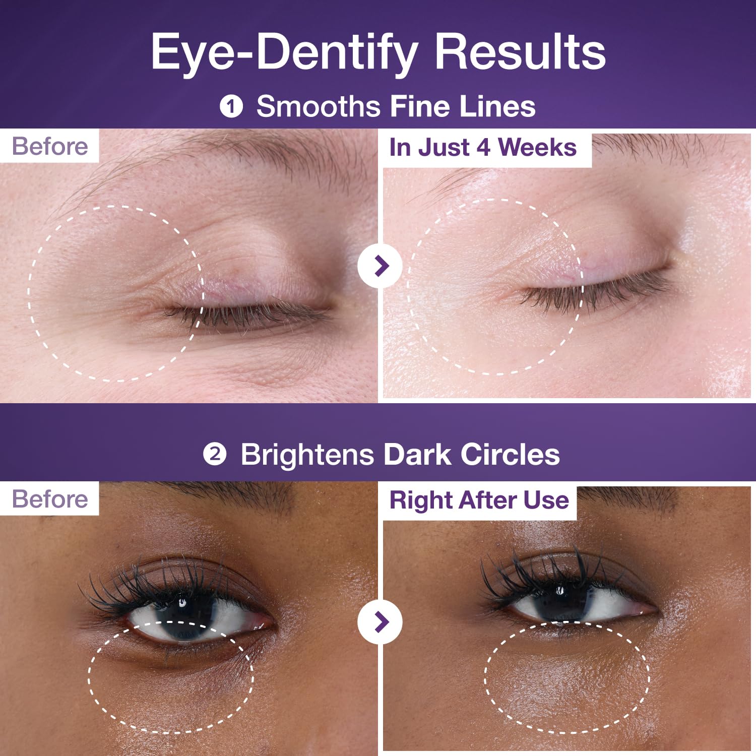 numbuzin No.9 Eye Cream | NAD+ Retinol Volumetox Eye Cream | Firming, Wrinkles, Fine Lines, Dark Circles, Puffy | Retinol, Peptides, Niacinamide | Undereye Treatment Serum | 0.33 fl. oz.