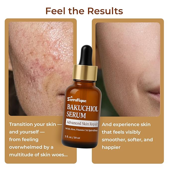 Bakuchiol Retinol Serum for Face - Retinol Alternative - Hydrating and Moisturizing - Anti Aging - Also Contains Aloe, Witch Hazel, Centella, Spirulina - 1 Fl. Oz. - Pack of 1