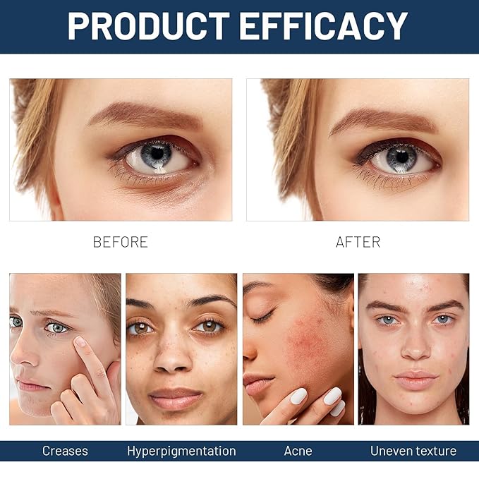 2PCS Paracress Facial Oil, Paracress Oil,Natural Paracress Extract Oil,Paracress Facial Serum Organic, Reduce Smooth Fine Lines and Wrinkles,for All Skin Types