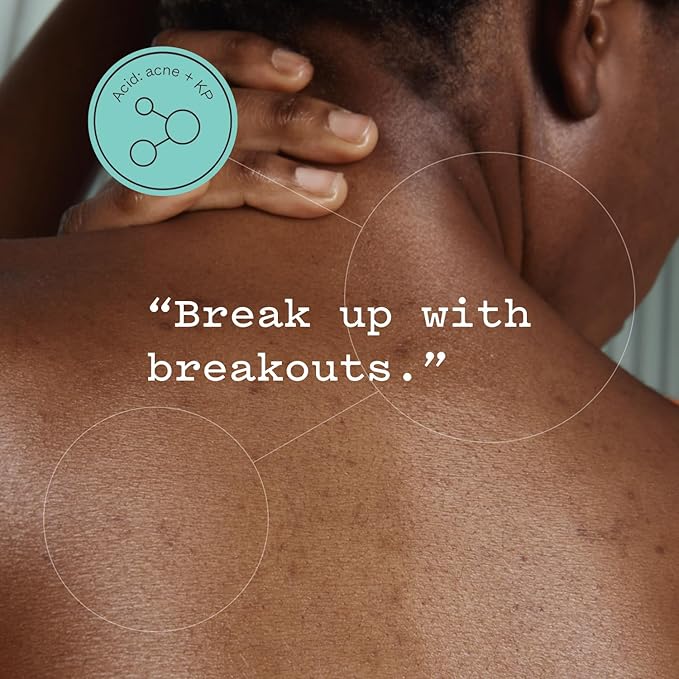 frank Body Glycolic Body Scrub | Vegan, Cruelty Free, Exfoliating Body Scrub | Helps to Fight Breakouts and Soothes Skin & Marks with AHA, Pumice, Witch Hazel, and Niacinamide | 8.82 oz / 250 g