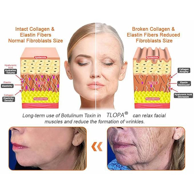 Botox Bee Venom Firming Serum Stick, Advanced Firming & Wrinkle-Reducing Cream, Bee Venom Wrinkle Remover Cream, Bee Venom Firming Serum Stick, Hydrates & Nourishes Skin (4PCS)