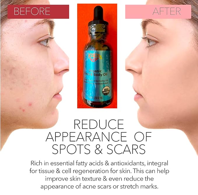 KOKOS Organic face and body oil, scar, stretch mark,Rosehip, Wheat Germ, Argan, Tamanu, Carrot, Rosemary, Lavender, Geranium, Patchouli, Sage oil