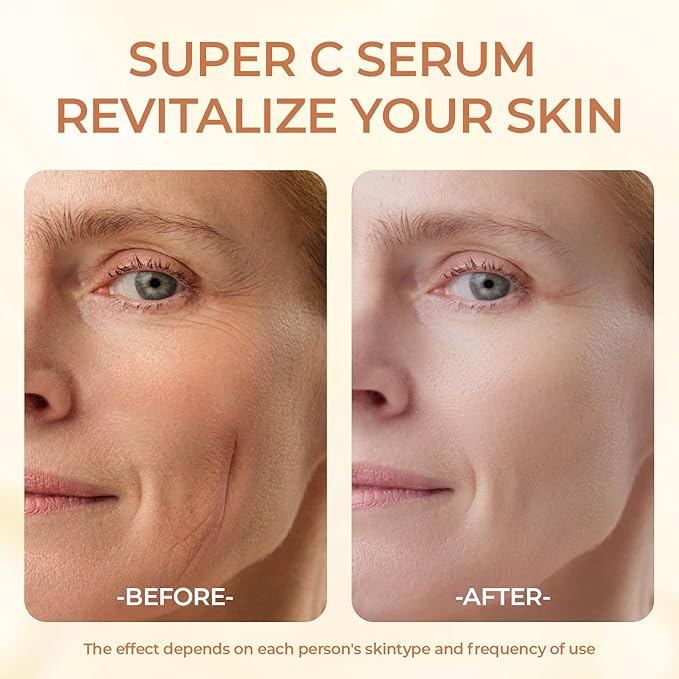 Super Vitamin C Serum for Women Over 70 - Hydrating Anti-Aging with Vitamin C Caffeine - Facial Skin Care for Mature Skin, Firming, Lifting, Smoothing, All in One Formula 1.69 fl oz