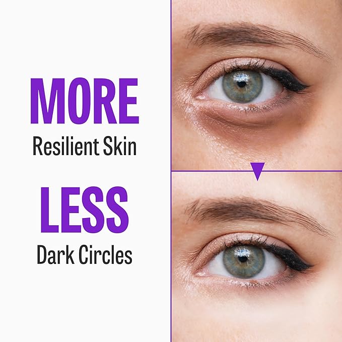 Time Return Melatonin Eye Cream for Dark Circles & Fine Lines | Clarifying Eye Cream for Bags Under Eyes | Firming Eye Cream for Fine Lines| Moisturizing Eye Cream for Eye Care (0.70 oz)