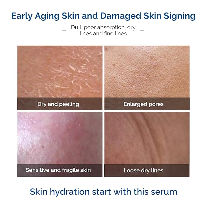 Advanced Argireline Peptide Serum - Wrinkle Defense & Hydration, 1 Fl.Oz