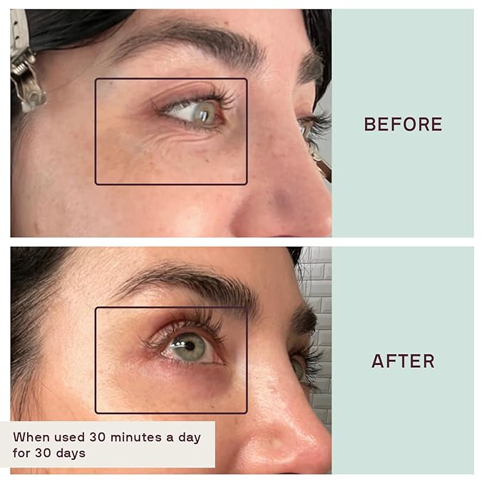 Dermaclara Eye & Mouth Patches - Anti-Wrinkle Silicone Patches for Smile Lines & Under Eye, Overnight Face Pads for Women & Men for Laugh & Frown Lines, Anti Aging, Reusable up to 30 Times - 4 Patches