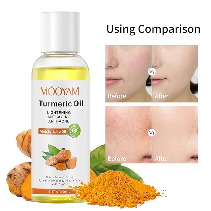 Turmeric Oil Organic Body Oil for Skin,Turmeric Essential Oil Massage Oil for Body and Face, Dark Spots, Ance, Hair Care, Moisturize Hydrating Turmeric Body Oil After Shower(100ml) Christmas Gifts