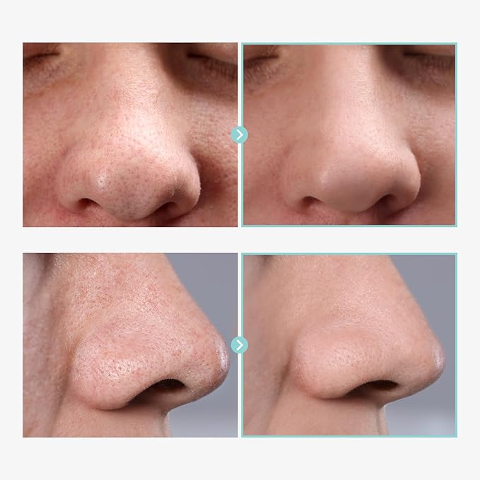 Pore Tightening Serum, Instantly Reduces Pores, Smooths Skin & Strengthens Barrier, Formulated With Niacinamide & Allantoin, Pore Minimizer For Face, Korean Skin Care, 30ml, 1.01 fl. oz.