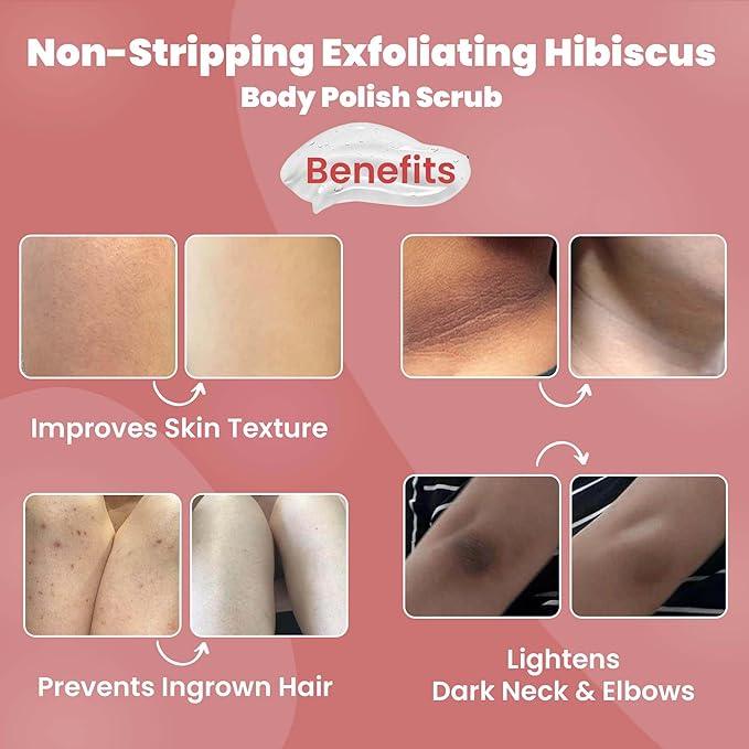 WildOak Aloevera, Sandalwood, Hibiscus Body Scrub | Lightens Dark Area Like Neck & Elbows | Smoothen Bumpy Legs & Hands | Remove Dead Skin | Enriched with Pearl Paste, Orange Peel, Rose | 100gm