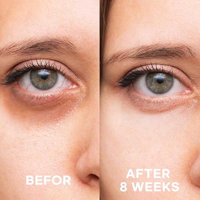 Epielle Brightening Eye Cream | Anti-Aging Serum for Dark Circles & Wrinkles | Cooling Applicator for Refreshing Application | Korean Skincare