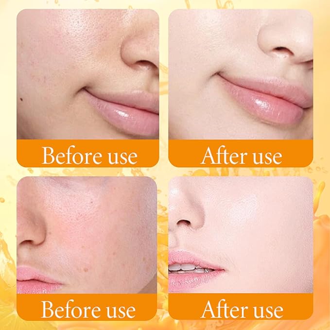 Skincare Kit Vitamin C Women Gifts - Skin Care Set Antioxidant - 5PCS Teen Skin Care Kit - Moisturizing Skincare Set - Skincare Gift Set for Women - with Cleanser, Toner, Serum, Eye Cream, Face Mask