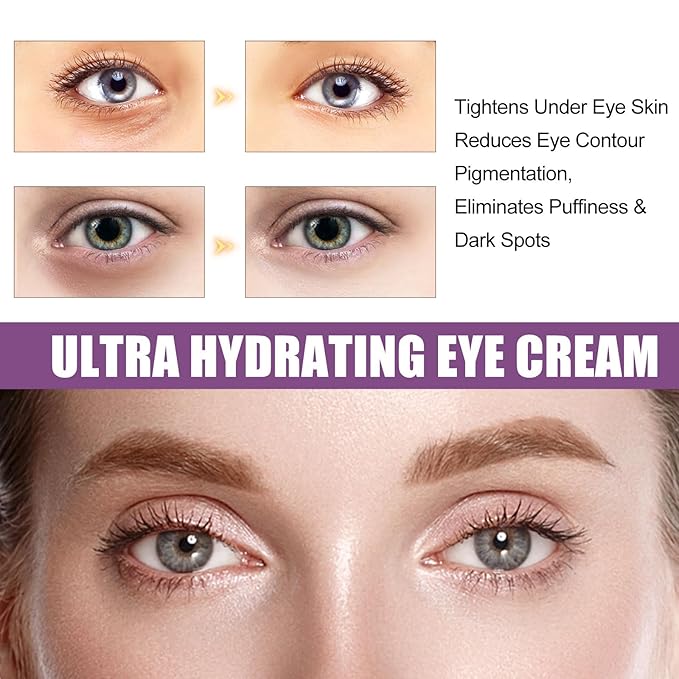 Eye Serum Under Eye Cream, Dark Circle and Puffiness Treatment - Hydrating Eye Cream for Wrinkles, Reduce Fine Lines, Bags Under Eyes