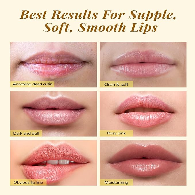 ANAI RUI Lip Care Kit - Sugar Scrub Set, Sleeping Mask & Exfoliator - Overnight Skin Treatment - Scrub & Moisturizer for Dry Chapped Cracked Peel Lips (Turmeric+Honey)