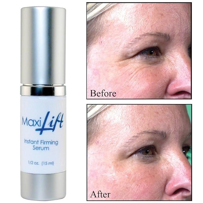 MaxiLift Serum, Instant Face Lift Cream, Skin Tightening Serum for Face & Instant Eye Lift, Smooth & Firm Loose Sagging Skin, Fine Lines & Wrinkles Within 2 Minutes, 0.5 Fl Oz