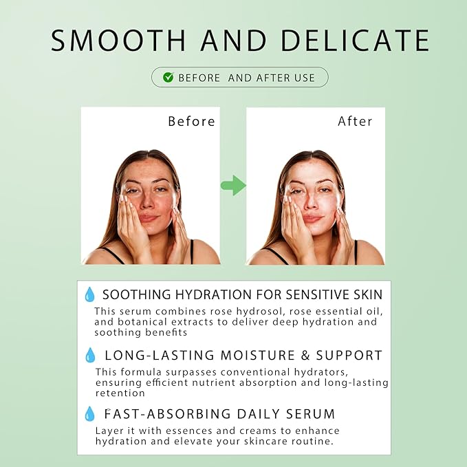 French Rose Essence Serum,Hydrating & Glowing Face Serum with Natural Rose Extracts, Anti-Aging, for All Skin Types - 3.4 Fl.oz