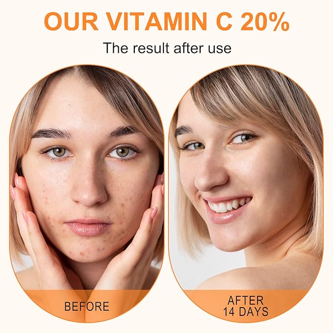 Premium 20% Vitamin C Serum For Face with Hyaluronic Acid, Retinol & Amino Acids - Boost Skin Collagen,Hydrate & Plump Skin, Anti Aging & Wrinkle Facial Serum 60ml