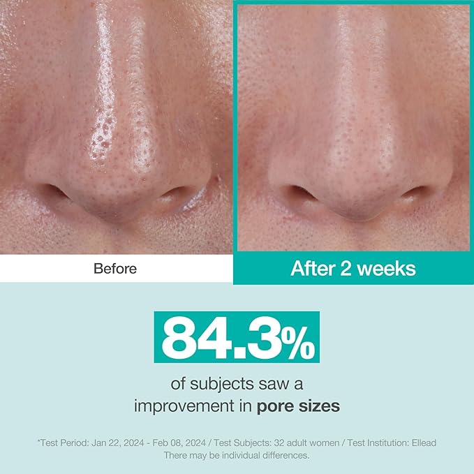 Physiogel Red Soothing CICA Balance Pore-Control Serum, Niacinamide Facial Exfoliant for Blackheads, Pore Minimizer Serum for Face, Korean skin care, 1.69 fl.oz